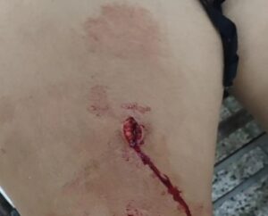 Mujer resulta herida con arma blanca en Pedro Juan Caballero tras discusión con otra