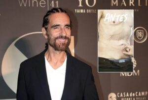 ¡Actor de «Pedro el escamoso» muestra el antes y después de su nuevo tuneado!