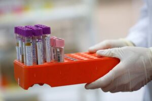 Esto indica el IPS sobre el laboratorio y toma de muestras en Villeta